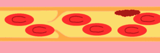 ʲôL